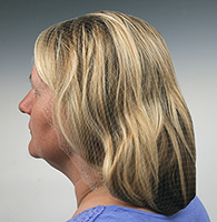 Located on Catalog Page 134.
